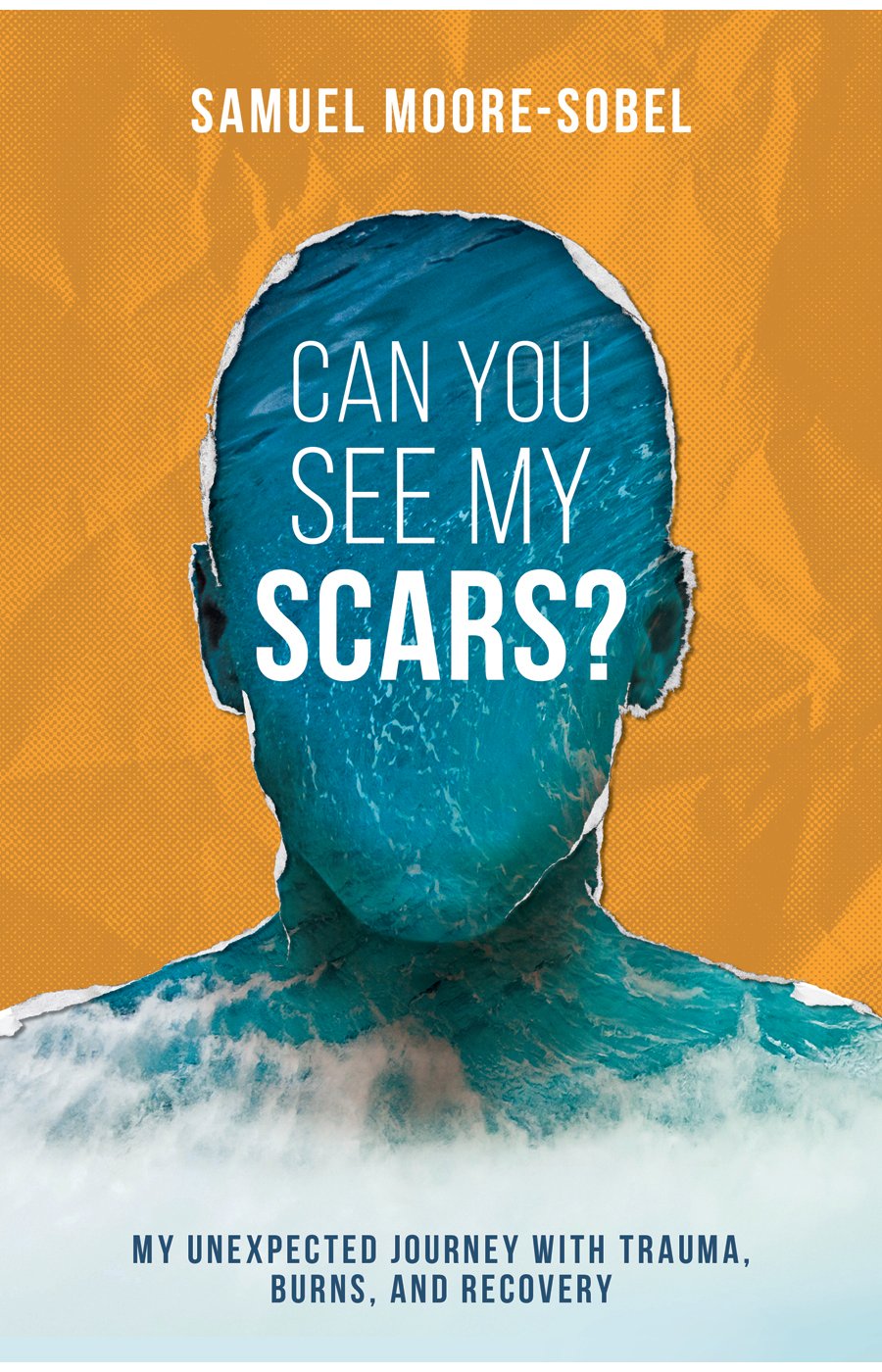 Can You See My Scars Cover